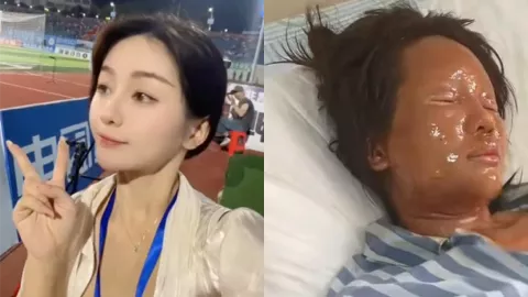 湖南网红思思毁容事件